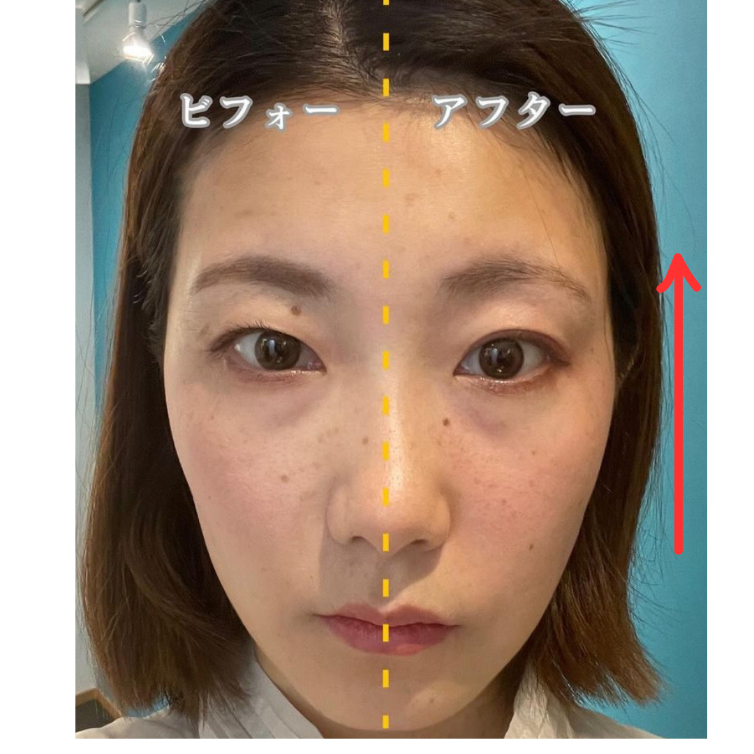 施術による変化