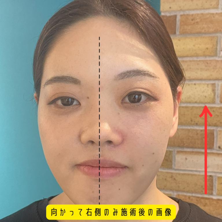 施術による変化
